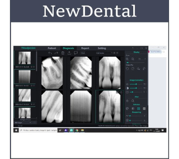 Visiograph, Radiovisiograph Woodpecker i - Sensor H2, Supports Windows 10. Protection IP68 фото 2