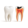 Pulp devitalization / Pulp extractors and root canals