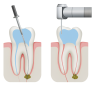 Instrumental processing of channels